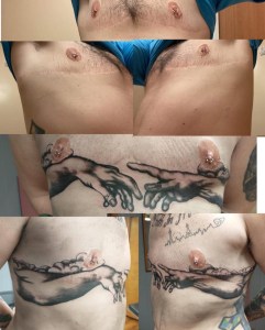 Photo collage of post-top surgery transgender man's chest and scars on top below tattoos cover his scars.